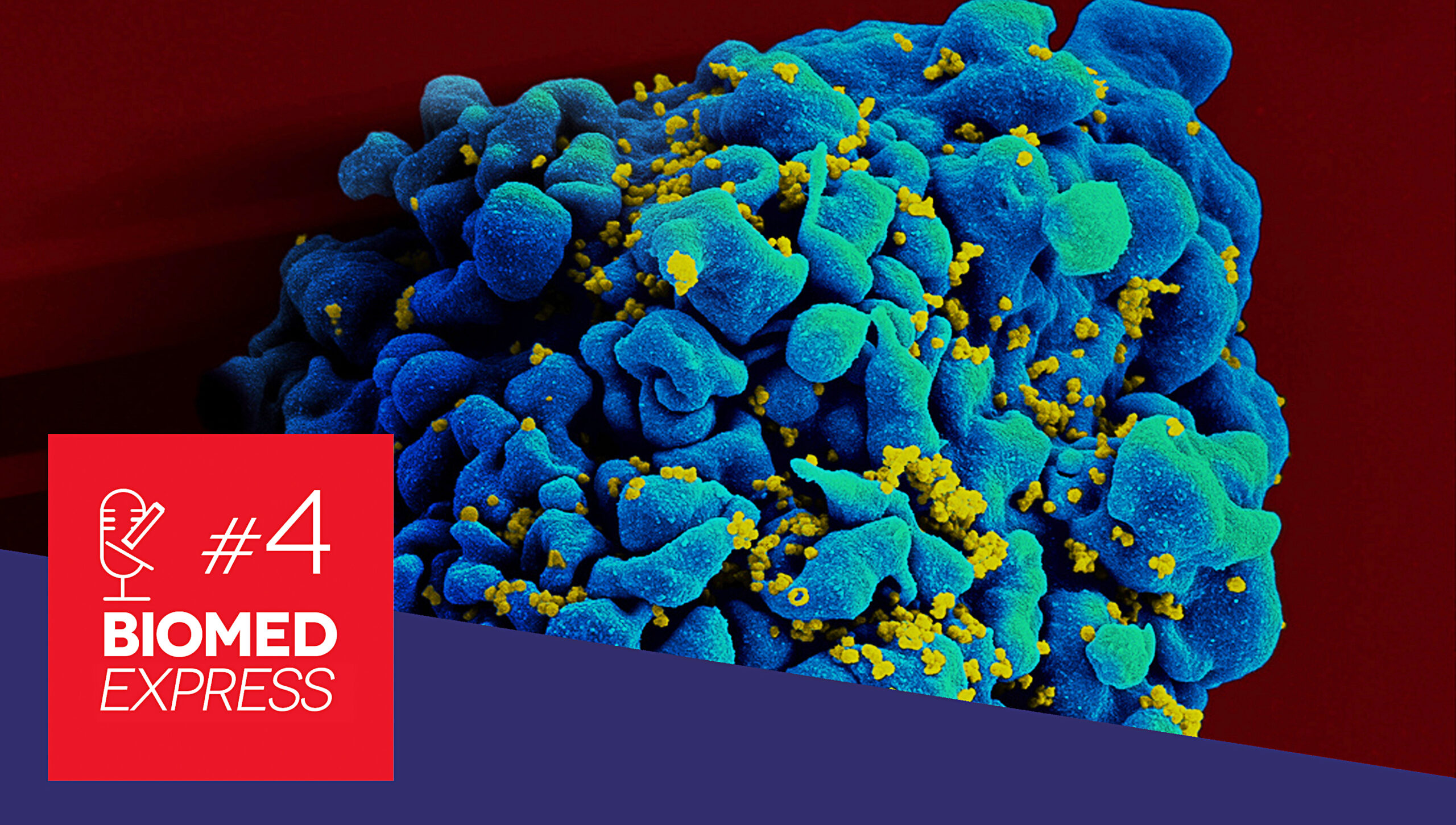 #4 Biomed Express – Anticorpos Monoclonais na Terapia do HIV