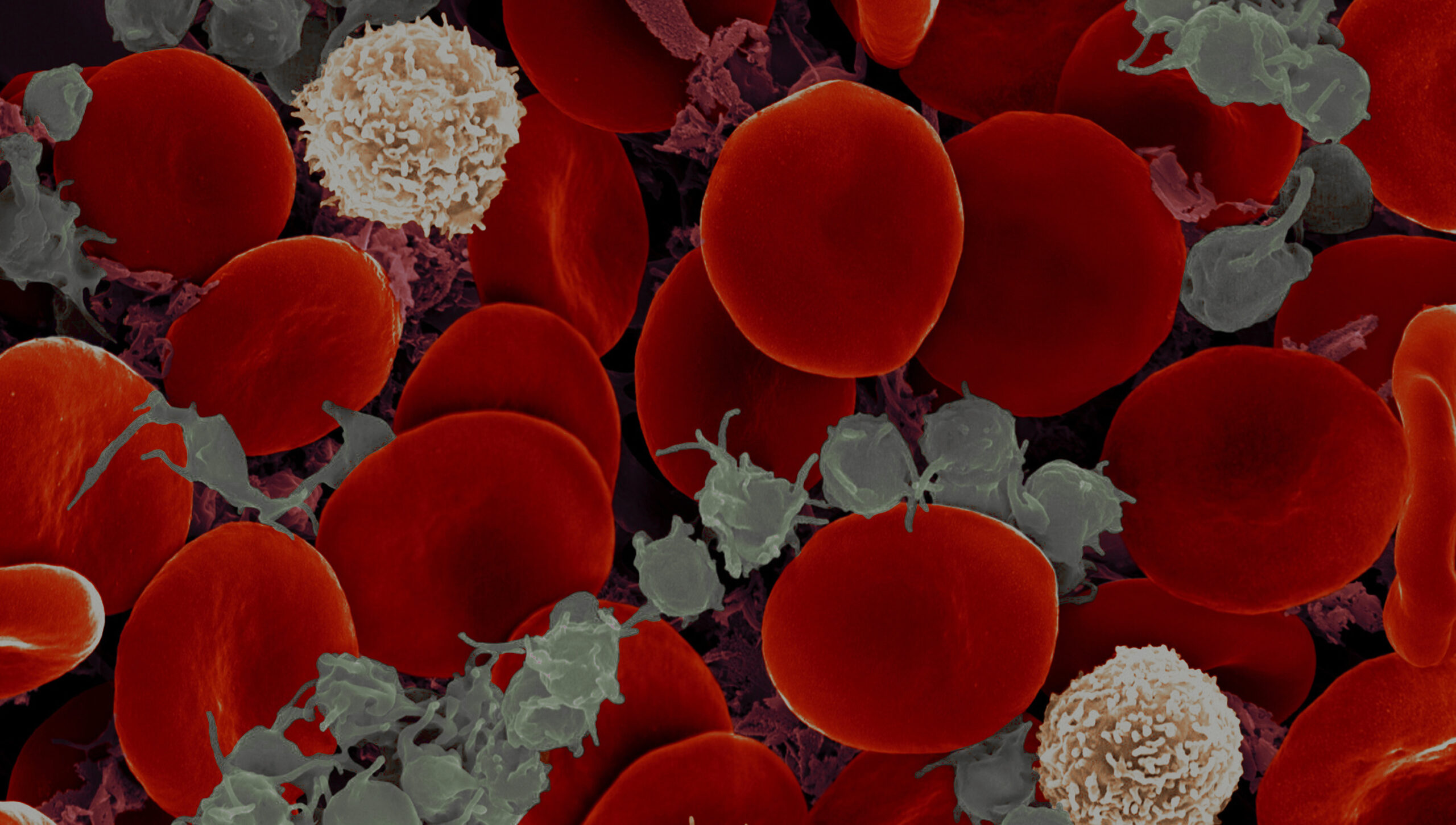 #42 Interpretação do Hemograma