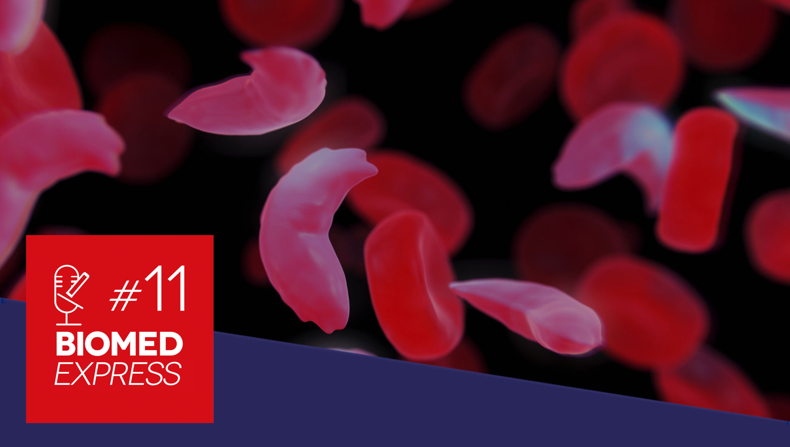 #11 Biomed Express – Corrigida Mutação que dá Origem à Anemia Falciforme