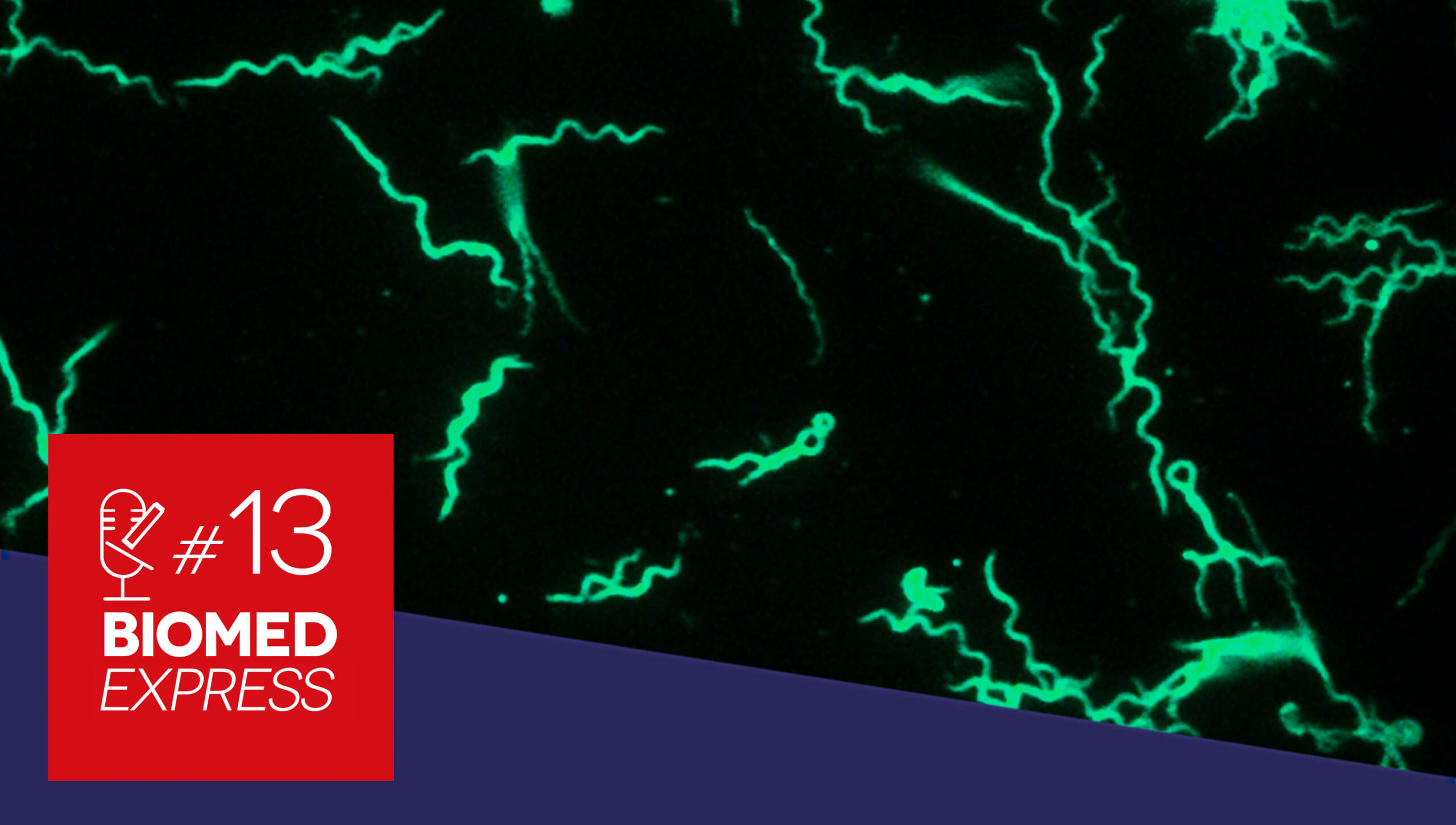 #13 Biomed Express – Epidemia de Sífilis no Brasil? 