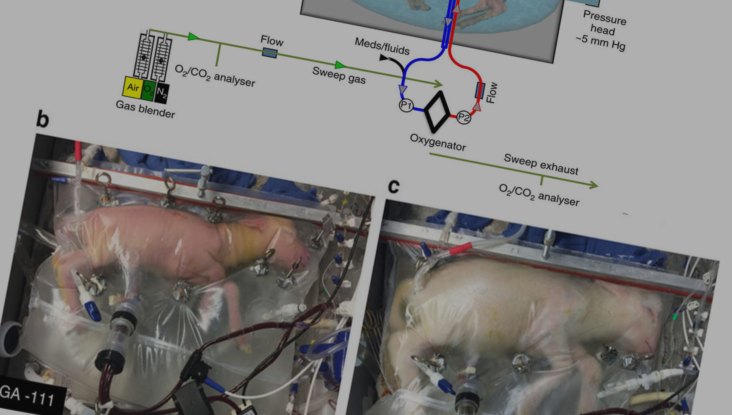 #55 Criaram um Útero Artificial: E agora?