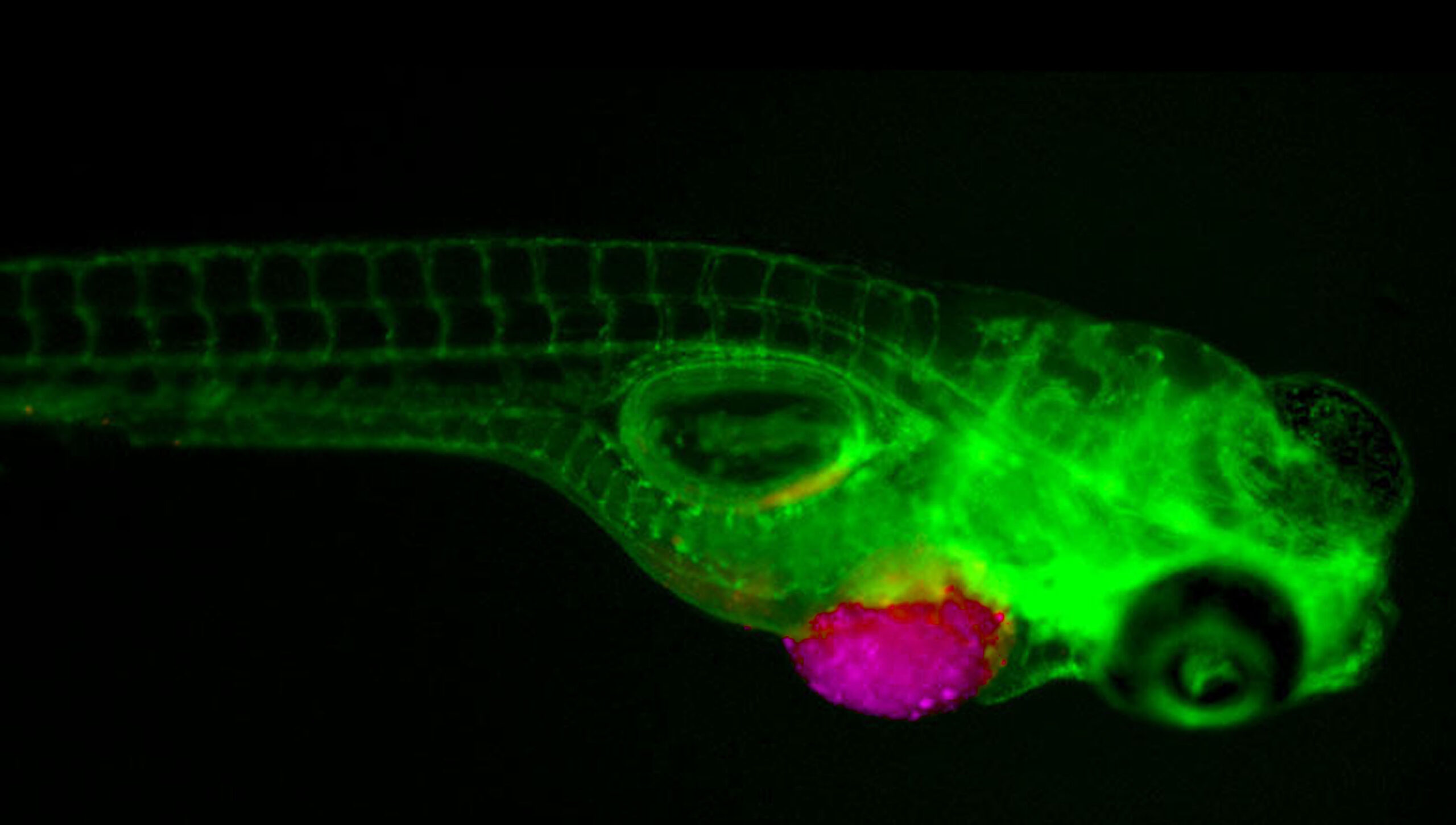 #61 Um Avatar Contra o Câncer